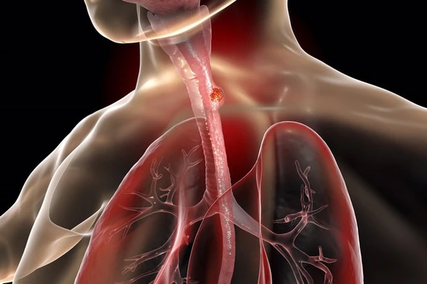 Cách uống trà làm tăng nguy cơ ung thư, nếu có hãy bỏ ngay!-1