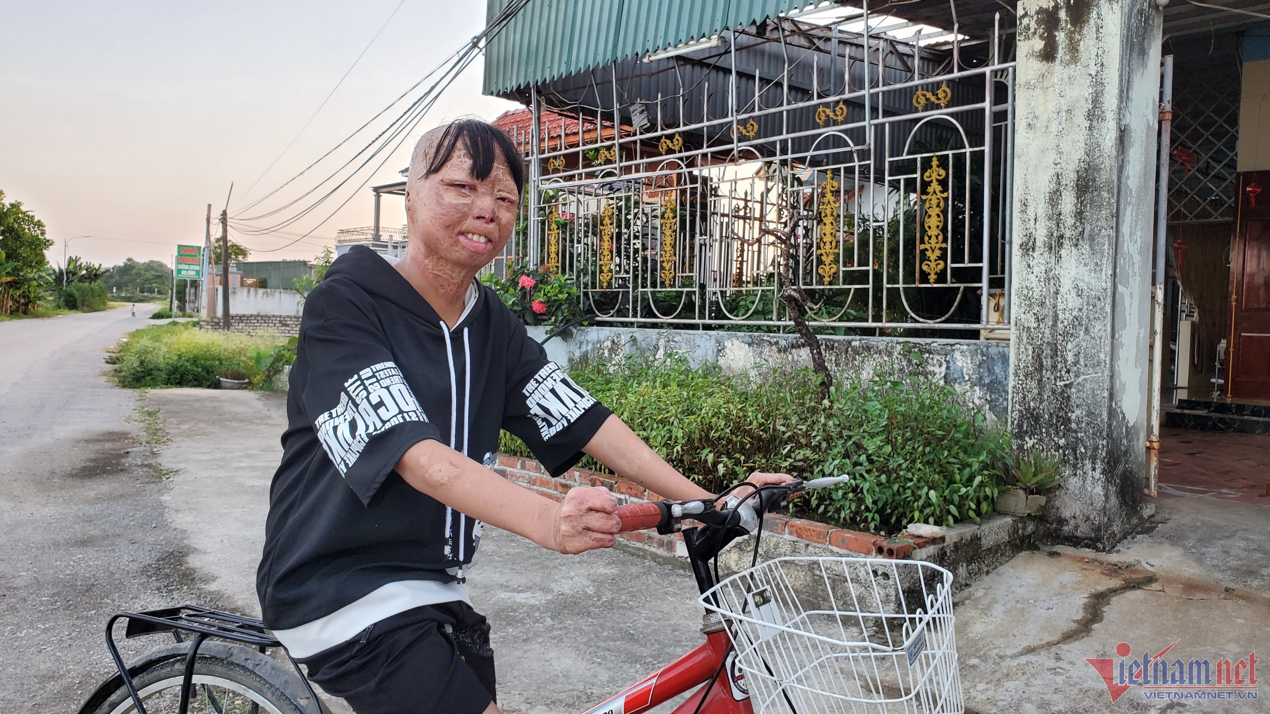 Cậu bé ở Thanh Hóa bị bố đổ xăng thiêu sống: Em ước mơ làm lính cứu hoả-4