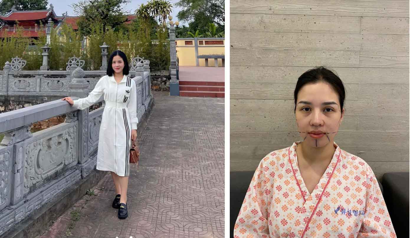 Cô gái 29 tuổi lột xác” sau khi chi 500 triệu chỉnh sửa nhan sắc: Đẹp có động lực làm việc hơn-1