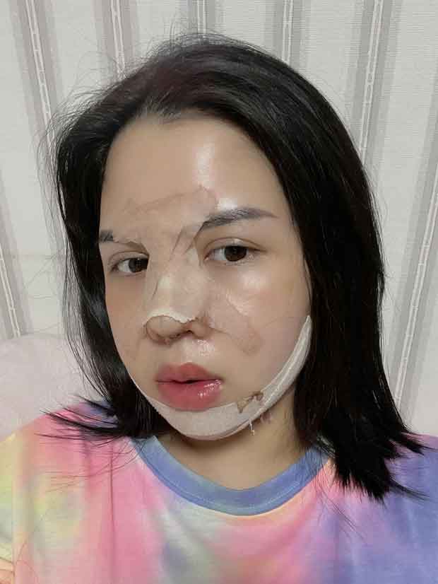 Cô gái 29 tuổi lột xác” sau khi chi 500 triệu chỉnh sửa nhan sắc: Đẹp có động lực làm việc hơn-2