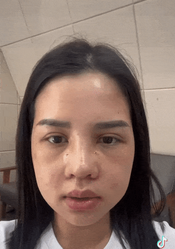 Cô gái 29 tuổi lột xác” sau khi chi 500 triệu chỉnh sửa nhan sắc: Đẹp có động lực làm việc hơn-3