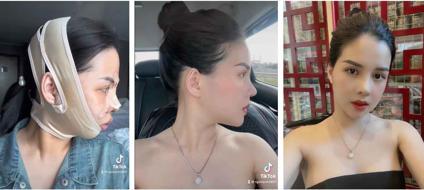 Cô gái 29 tuổi lột xác” sau khi chi 500 triệu chỉnh sửa nhan sắc: Đẹp có động lực làm việc hơn-4