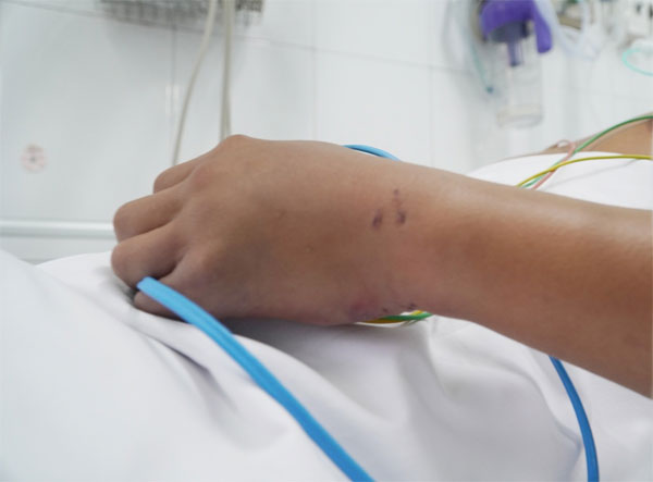 Người đàn ông mang rắn hổ chúa vào bệnh viện sau khi bị cắn-2