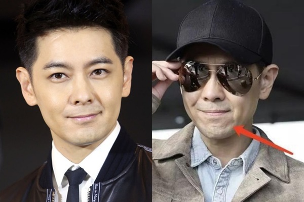 Xôn xao ảnh rõ nét gương mặt khác hoàn toàn của Lâm Chí Dĩnh sau ca phẫu thuật hậu tai nạn xe thảm khốc-4