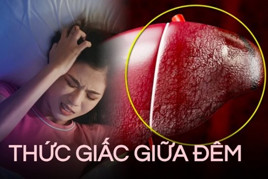 Tỉnh giấc lúc 3-4 giờ sáng: Bác sĩ cảnh báo có thể 2 cơ quan nội tạng đã bị tổn thương