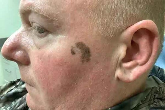 Phát hiện ung thư nhờ người lạ đi cùng tàu