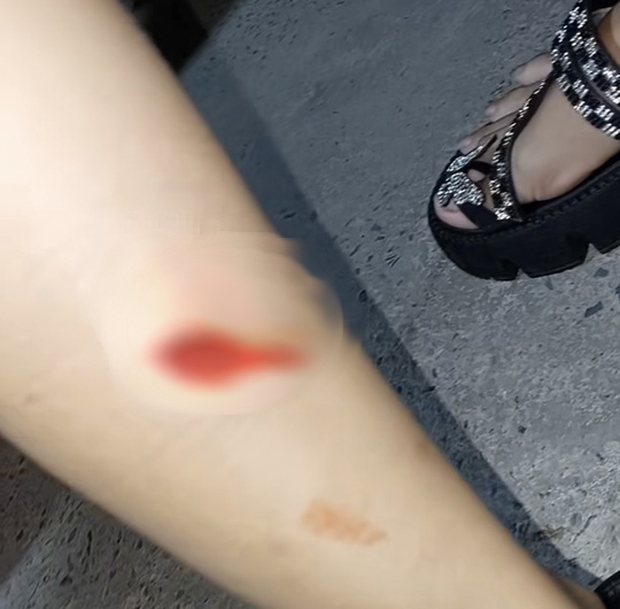 Xác minh thông tin đôi vợ chồng bị bắn khi đang lưu thông trên đường-2