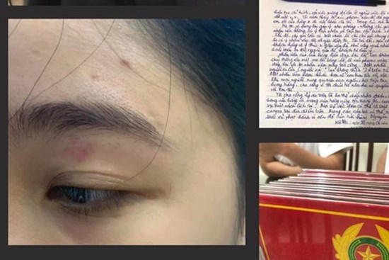 Cô gái tố bị nhân viên quán bánh mì ở phố cổ Hà Nội hành hung