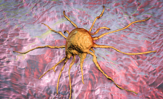 4 sở thích ăn uống độc hại có nguy cơ dẫn đến ung thư-3