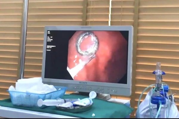 Bé trai nhập viện vì nuốt phải móc khóa-1