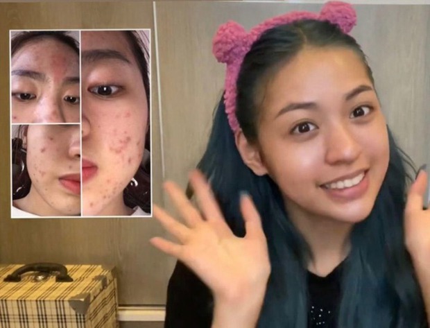 Cô gái lên đời nhan sắc, công khai yêu giám đốc sau khi giảm 15kg-4