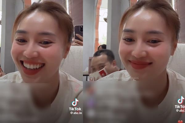 Ninh Dương Lan Ngọc khiến khán giả lo lắng khi lộ vết bầm tím lớn ở chân-5