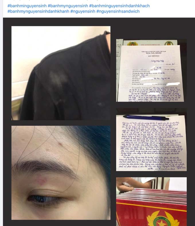 Vụ nhân viên quán bánh mì Nguyên Sinh đánh khách: Giám định thương tích-1