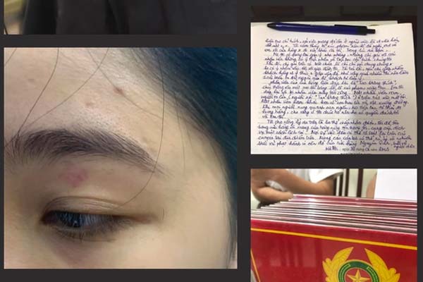 Cha dượng đánh bé trai 18 tháng tuổi tử vong bị đề nghị án 9-10 năm tù-3