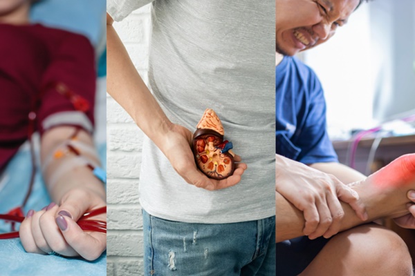 Nam thanh niên suy thận cấp, phải lọc máu do nhiễm xoắn khuẩn sau chuyến đi chơi thác-3