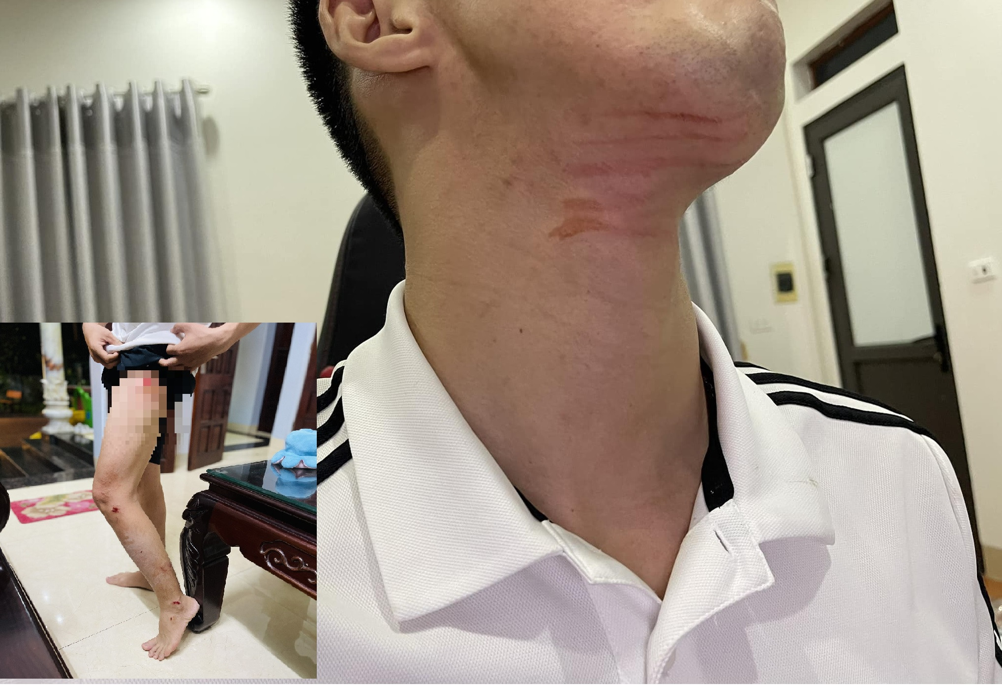 Đang hóng gió trước sân, cô gái giật mình thấy vật thể lạ trên trời rơi xuống-3