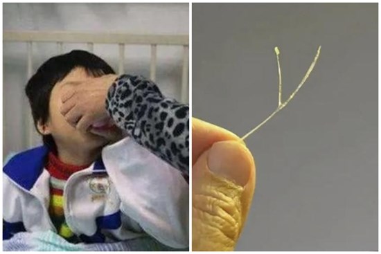 Con bị hóc xương cá, mẹ bỏ thêm một thứ vào miệng bé, bác sĩ tấm tắc khen: Hiếm người làm được như vậy!