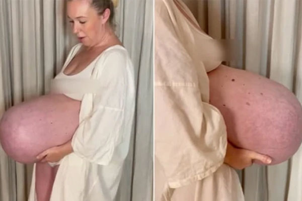 Sự hồi sinh của thai phụ bị chồng đẩy xuống vực để chiếm tài sản-3