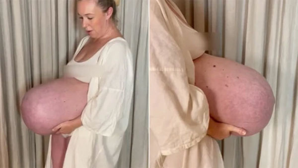 Chiếc bụng bầu kỳ quặc khiến thai phụ sốt xình xịch trên mạng xã hội-1