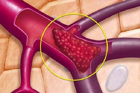 6 loại thực phẩm là 