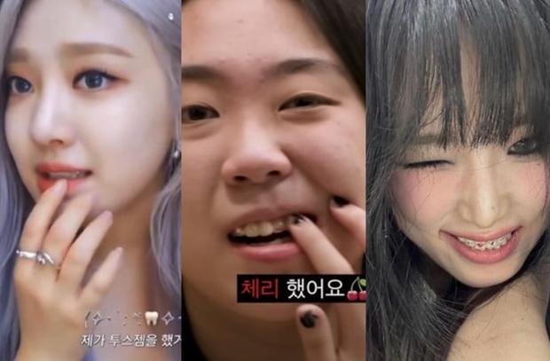 Trend răng đính đá” được Lisa và loạt idol mê mẩn dạo này bỗng gây tranh cãi-3