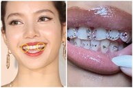 Trend “răng đính đá” được Lisa và loạt idol mê mẩn dạo này bỗng gây tranh cãi
