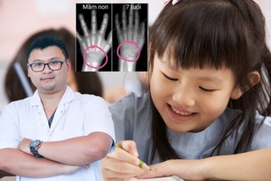 Cho trẻ tập viết quá sớm sẽ ảnh hưởng đến sự phát triển của xương: Bác sĩ chuyên khoa nói gì?