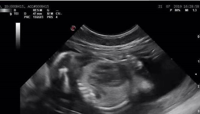 Bố mẹ tiến sĩ sinh con gái thần đồng, 2 tuổi đã thuộc mặt chữ, BS giỏi lại yêu cầu nhập viện tâm thần sớm-3