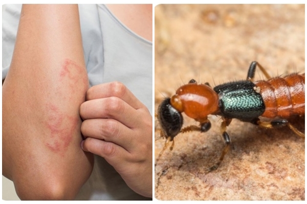 Chưa hết khổ vì muỗi, người Hà Nội lại bị kiến ba khoang hành-4