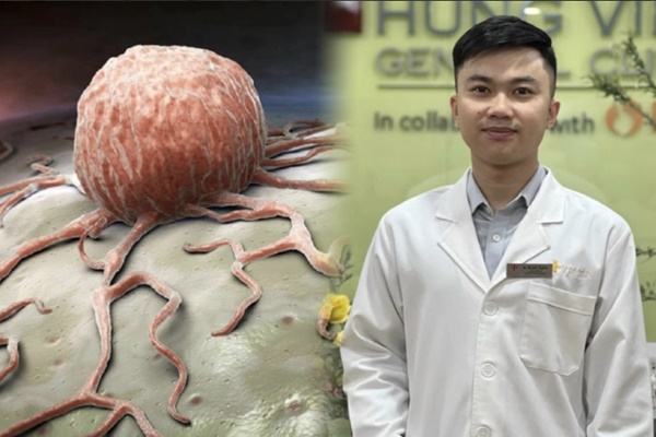 Rộ tin nước chanh diệt ung thư tốt hơn hoá trị: Tác dụng thực sự ra sao?-2