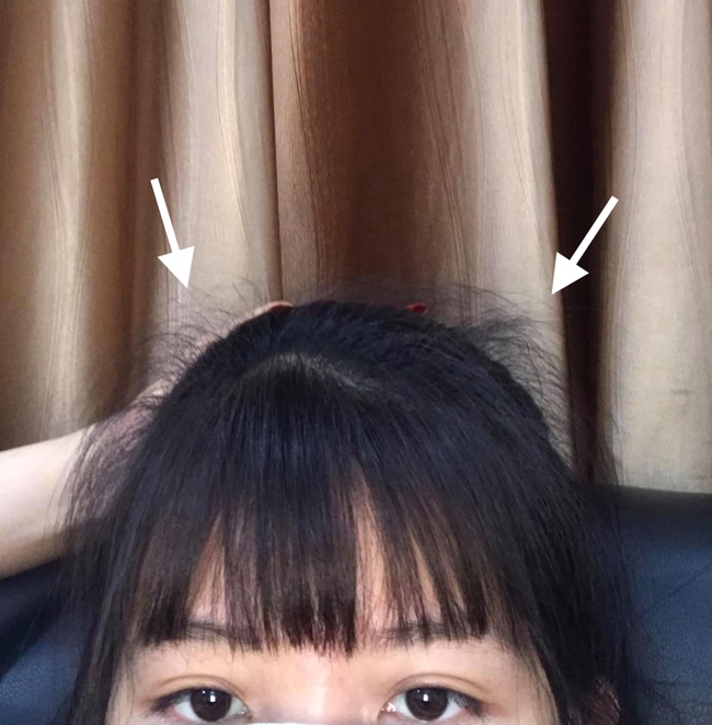 Tóc rụng cả búi chuyển sang bồng bềnh, đen bóng chỉ nhờ chăm ủ tóc tại nhà-2