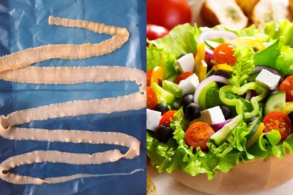 Hà Nội: Thích ăn phở tái, cô gái có sán 6m ngọ nguậy trong người-4