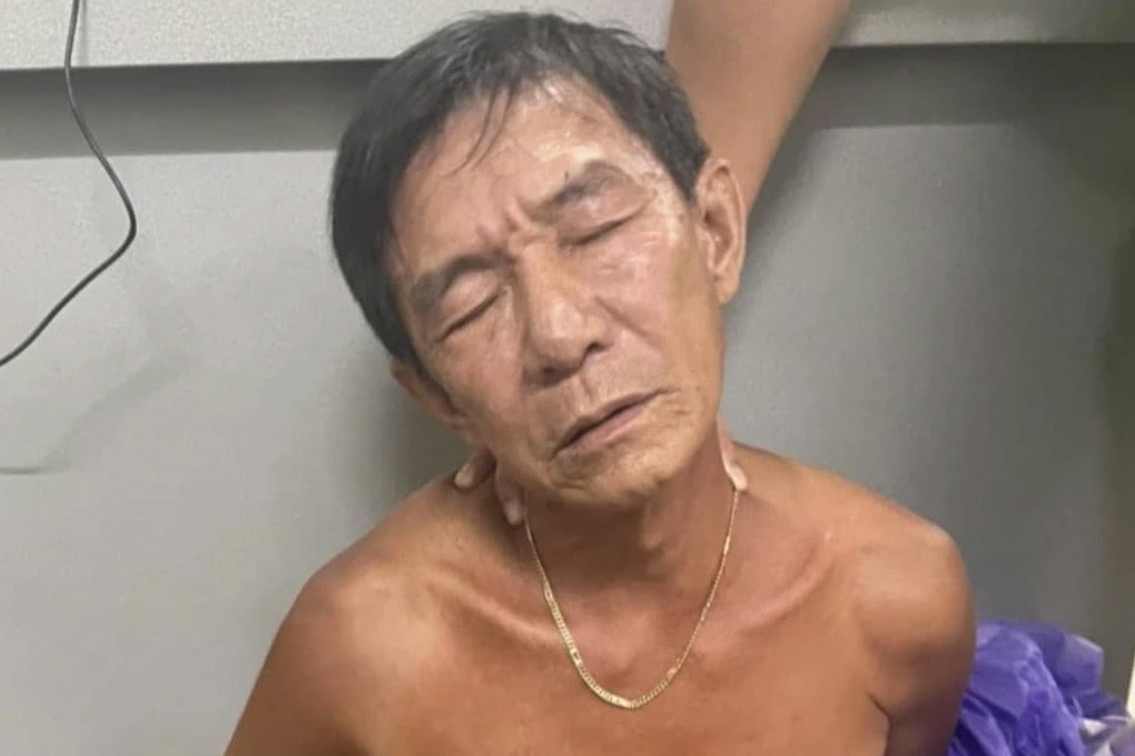 Đang nhậu rồi xin về trước, người đàn ông bị bạn đâm nguy kịch-1