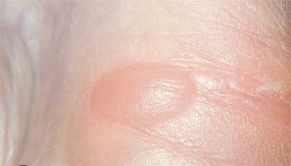 Đứng bên cửa sổ ngắm giông bão, hai mẹ con bị sét đánh-2