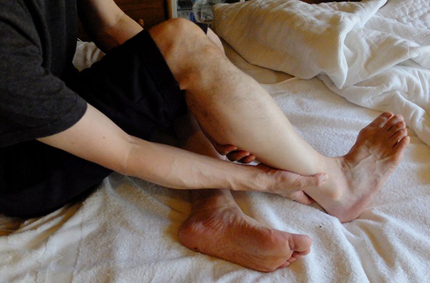 Bác sĩ: Lưu ý để phân biệt chuột rút với các bệnh lý nguy hiểm khác-1