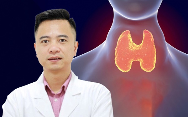 9 nguyên nhân không ngờ gây suy giáp được bác sĩ ung bướu chỉ rõ-1