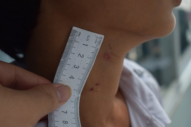 Tạm giữ hình sự gã cha dượng 9X đốt vùng kín con riêng của vợ-4