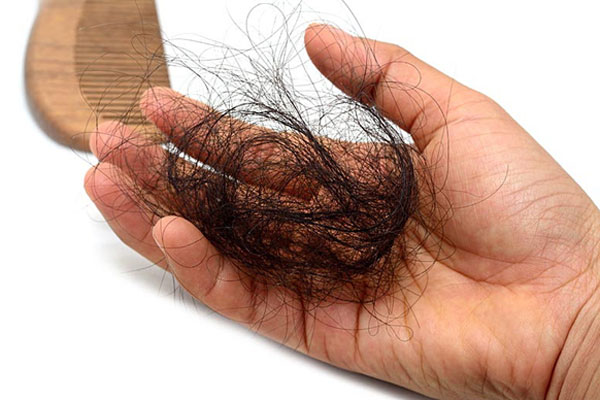 Còn trẻ đã rụng tóc: Coi chừng vì ghiền” những thức uống này-2