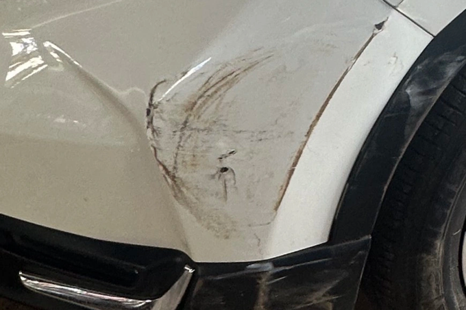 Mâu thuẫn vì chỗ đỗ ô tô, bác sĩ bị hàng xóm đánh tại phòng khám-3