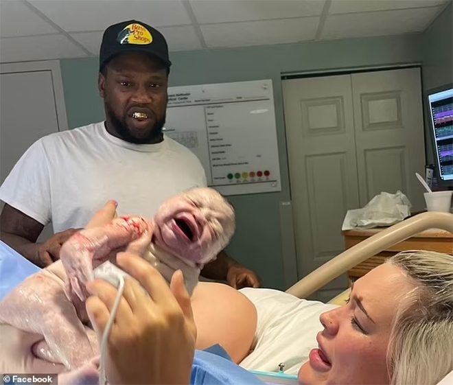 Biểu cảm buồn cười của ông bố khi chứng kiến con chào đời gây sốt mạng xã hội-2