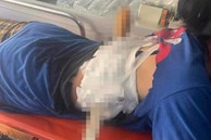 Người phụ nữ ở Hà Tĩnh bị chồng dùng dao nhọn phóng xuyên lưng