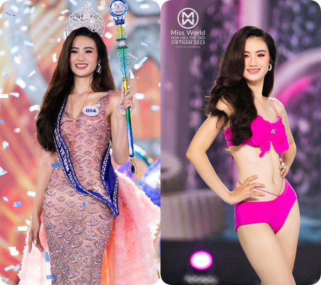 Tân Miss World Việt Nam Huỳnh Nhi lên đời” nhan sắc nhờ niềng răng-1