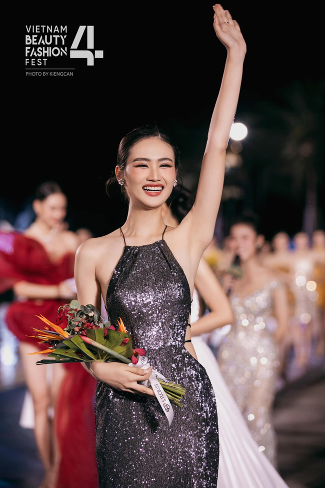 Tân Miss World Việt Nam Huỳnh Nhi lên đời” nhan sắc nhờ niềng răng-2