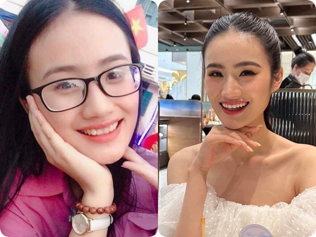 Tân Miss World Việt Nam Huỳnh Nhi lên đời” nhan sắc nhờ niềng răng-6