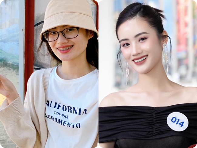 Tân Miss World Việt Nam Huỳnh Nhi lên đời” nhan sắc nhờ niềng răng-7