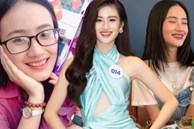 Tân Miss World Việt Nam Huỳnh Nhi “lên đời” nhan sắc nhờ niềng răng