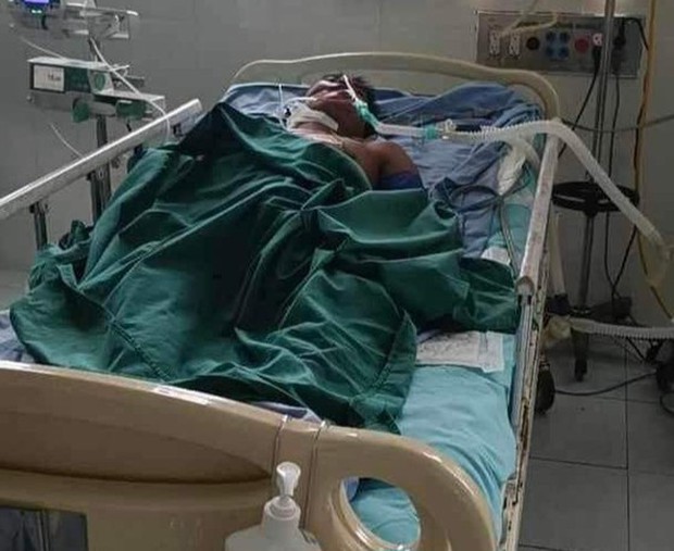 Quảng Nam: Người đàn ông nguy kịch do bị ong vò vẽ đốt-1