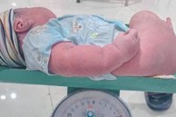 Sản phụ Nghệ An sinh thường con thứ 6 là bé trai nặng 5kg