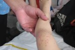 Vào điểm nóng đang điều trị hàng trăm trẻ mắc tay chân miệng ở TPHCM-12