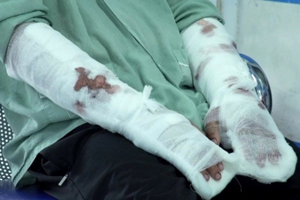 Chó becgie 50kg tấn công khiến nam thanh niên chịu hàng trăm vết thương-1